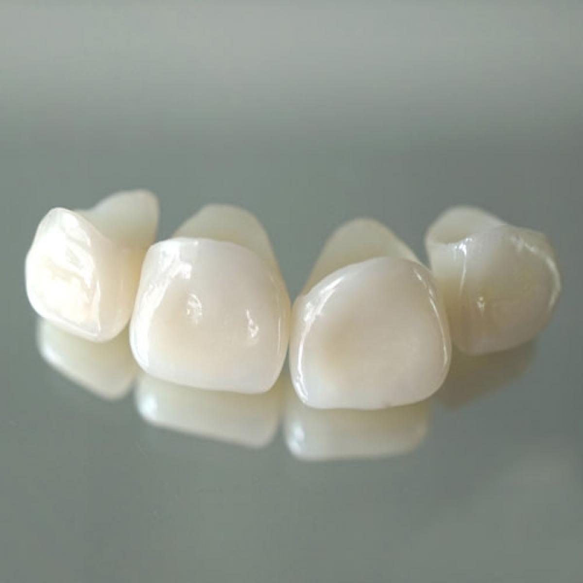 коронки для зубов керамика фото